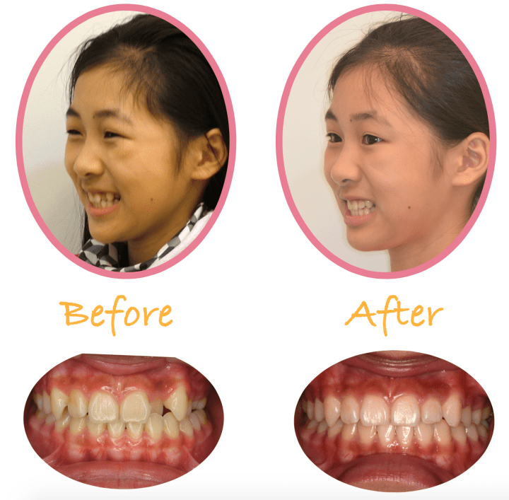 Screen Shot 2016-08-27 at 12.32.14 AM