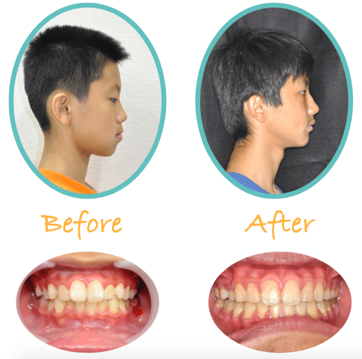 Screen Shot 2016-08-27 at 12.32.29 AM