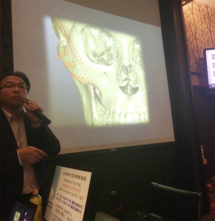 北醫矯正研討會 謝明吉醫師演講 顳顎關節