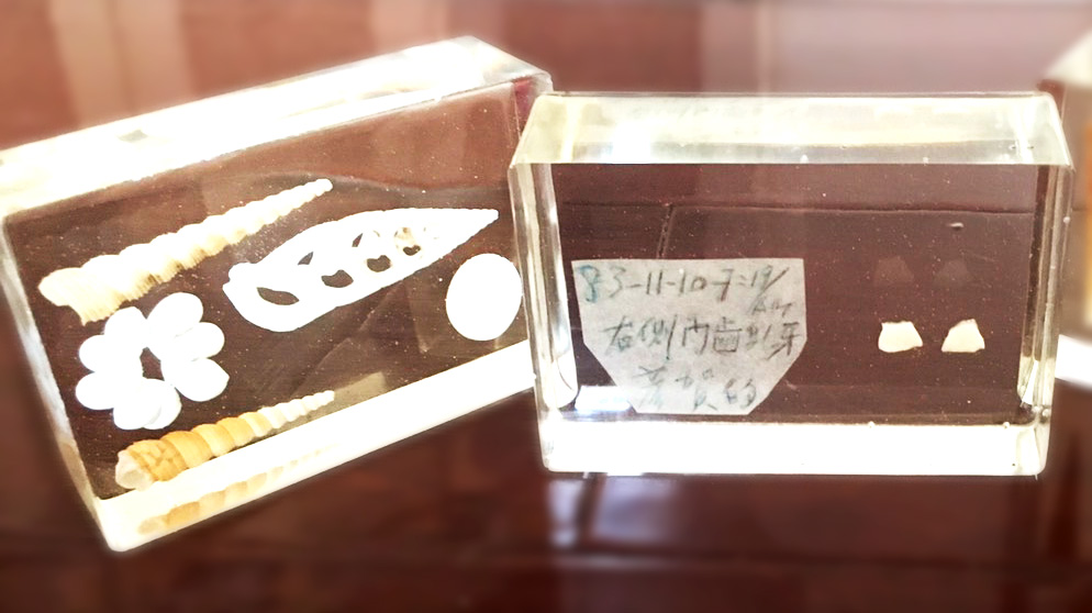 牙齒也能像貝殼一樣保存起來變裝飾紀念品喔！