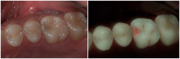 如果有細菌就會看到紅色的光