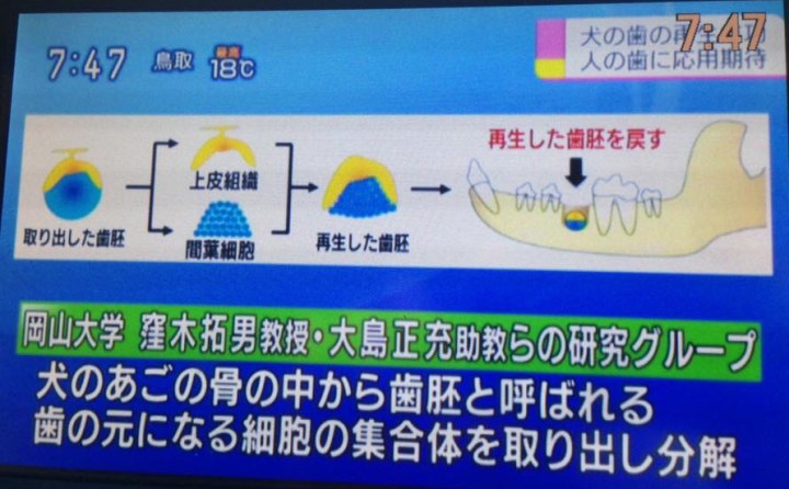 牙齒再生新突破