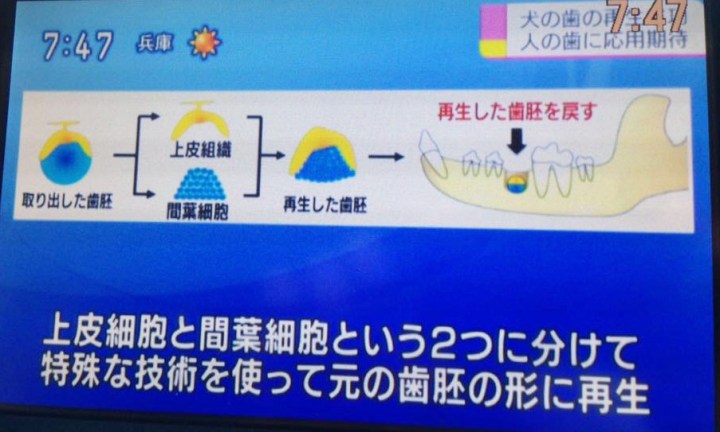 牙齒再生新突破