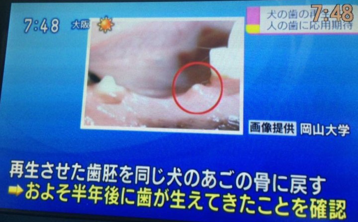 牙齒再生新突破