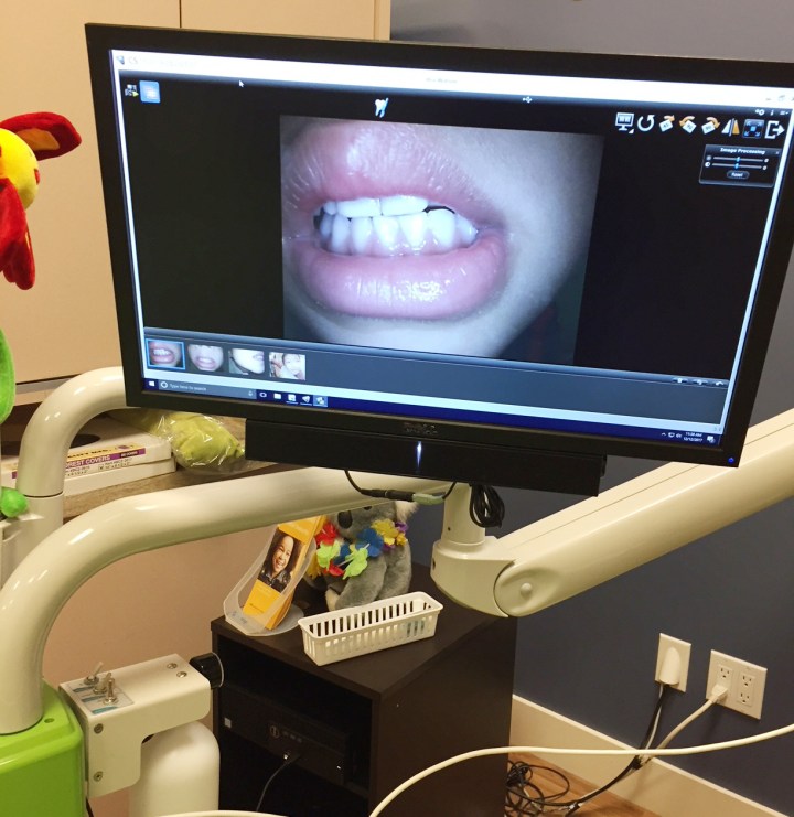 電視直播 - 用相機直播到螢幕上，讓小朋友清楚看到自己的牙齒
