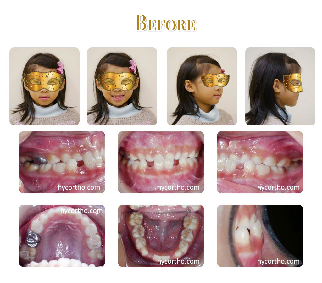 黃醫師的快樂小小朋友 - 治療前