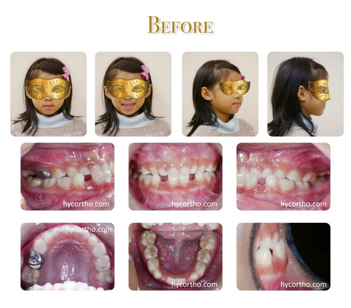 黃醫師的快樂小小朋友 - 治療前